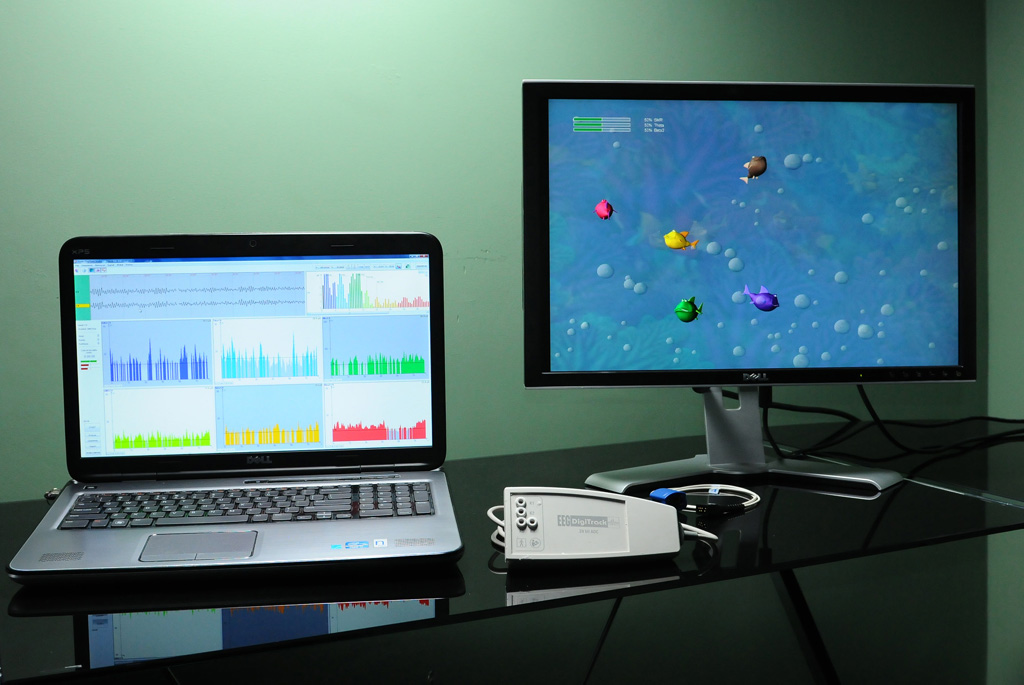 NFB system